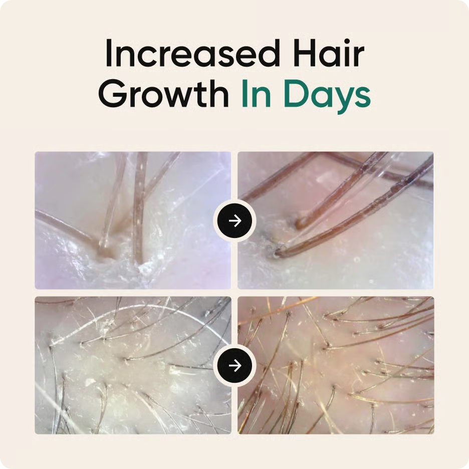Ultimate Hair Nourishment Spray 4 in 1